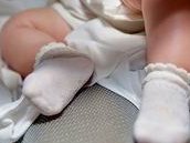 浅析为何大部分都是试管婴儿，可选择植入胚胎数量是主因