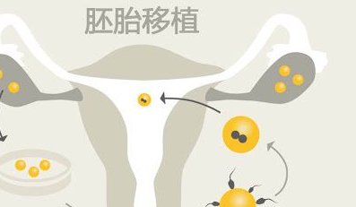 试管移植后躺姿与时间管理，助力好孕到来！